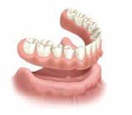 Clinica Dental Ica prótesis dental